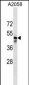 MRGPRF Antibody (C-term)