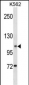 ANO1 Antibody (Center)