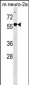 B4GALNT1 Antibody (Center)