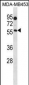 B4GALNT1 Antibody (Center)