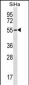 RNF150 Antibody (N-term)