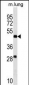 RNF150 Antibody (N-term)
