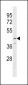 SERPINB12 Antibody (Center)