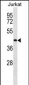 TRHR Antibody (Center)