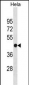 FH Antibody (N-term)