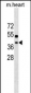 TTC35 Antibody (Center)