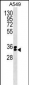 FBXO44 Antibody (N-term)