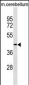 TMOD2 Antibody (N-term)