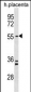 PAPD5 Antibody (N-term)