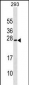 EXOSC1 Antibody (C-term)