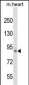 KLHL1 Antibody (N-term)