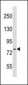 CTEN Antibody (N-term)