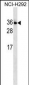 IL34 Antibody (N-term)