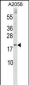 SNX3 Antibody (Center)