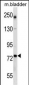 GCLC Antibody (Center)