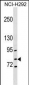 GCLC Antibody (Center)