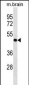 PPP4R2 Antibody (Center)
