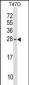 Bax Antibody (Center)