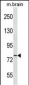 CDH11 Antibody (C-term)