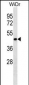 ERLIN2 Antibody (C-term)