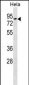 RHOT1 Antibody (N-term)