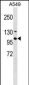 RNF111 Antibody (N-term)