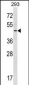 RNF41 Antibody (C-term)