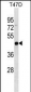 IL22RA2 Antibody (N-term)