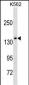 MLLT2 Antibody (C-term T1196)