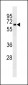 CD25 Antibody