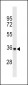 DYT1 Antibody