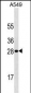 HPRT1 Antibody(Ascites)