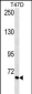 VTN Antibody(Ascites)