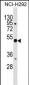 ANXA10 Antibody (C-term)