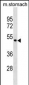 ANXA10 Antibody (C-term)