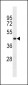 HHCM Antibody (C-term)
