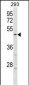 HORMAD1 Antibody (Center)