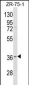 RNF144B Antibody (Center)