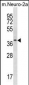 THOC6 Antibody (Center)