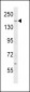 IQGAP2 Antibody (C-term)