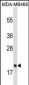 PGLYRP1 Antibody (C-term)