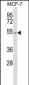 PTEN Antibody (Center S385)