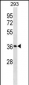 SMN1 Antibody (C-term)