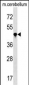 PPIL4 Antibody (N-term)