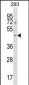 STARD7 Antibody (N-term)