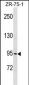 PCDHGB1 Antibody (C-term)