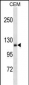 AMOT Antibody (N-term)