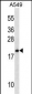 MRPL40 Antibody (C-term)