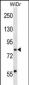 SEC23B Antibody (C-term)