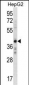 AEBP2 Antibody (C-term)